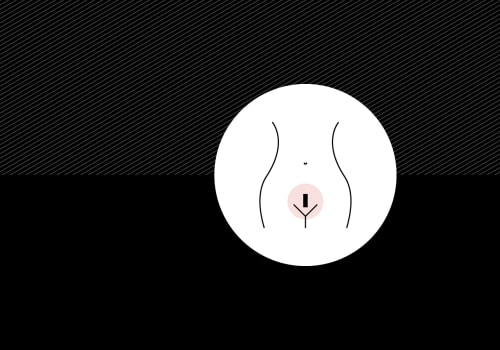 Does Laser Hair Removal on Pubic Area Hurt? - An Expert's Perspective